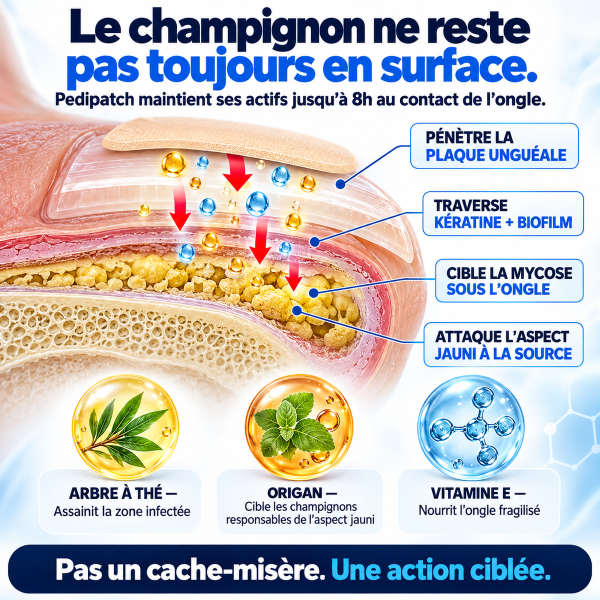 Pedipatch Ongle Net